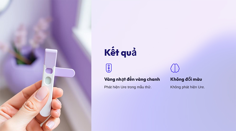 Test kit kiểm tra nhanh Ure Bộ Công An BCA 8 Test kit kiểm tra nhanh Ure Bộ Công An BCA - Ảnh 4