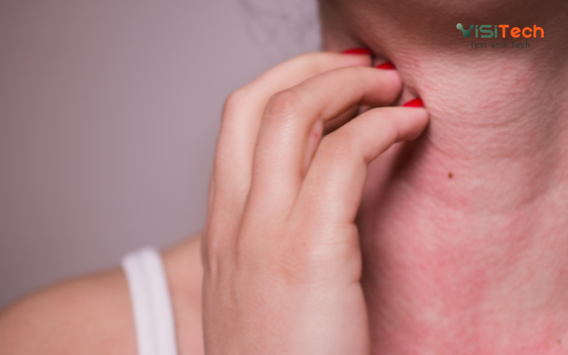 Sulfit là gì? Sulfit có độc không? 5 tác hại cần biết khi dùng 7 Sulfit là gì? Đây là hợp chất hóa học được sử dụng rộng rãi như chất bảo quản và chống oxy hóa